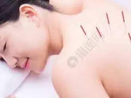 针灸